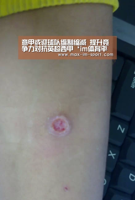 意甲或迎球队编制缩减 提升竞争力对抗英超西甲‘im体育平台’(图3) im体育下载
